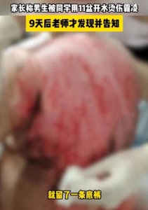 ​广西男孩被浇11盆开水，云南学生被同学砍杀，一天两起，个个凶残