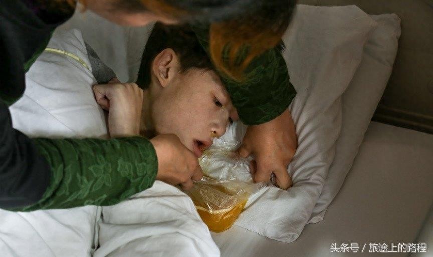 直击”骷髅男孩“一生，每天靠药物维持生活，亲戚建议“安乐死”