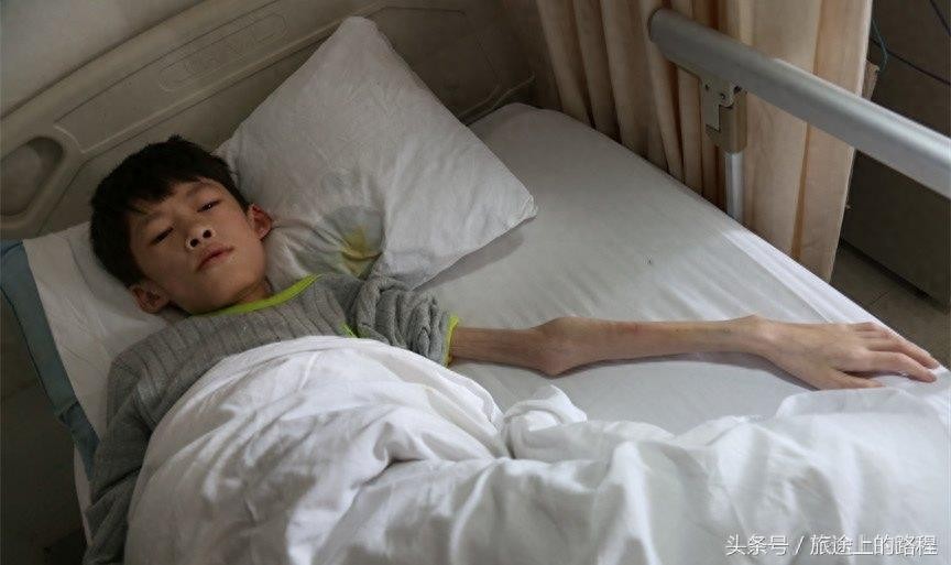 直击”骷髅男孩“一生，每天靠药物维持生活，亲戚建议“安乐死”