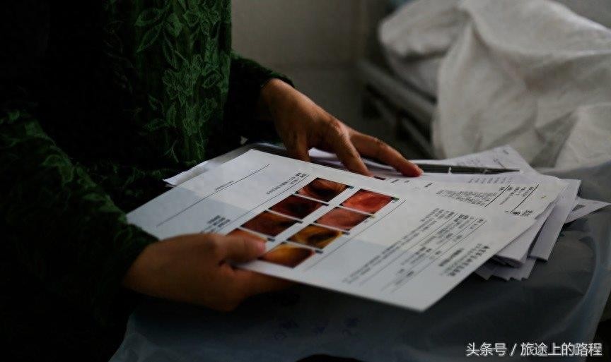 直击”骷髅男孩“一生，每天靠药物维持生活，亲戚建议“安乐死”