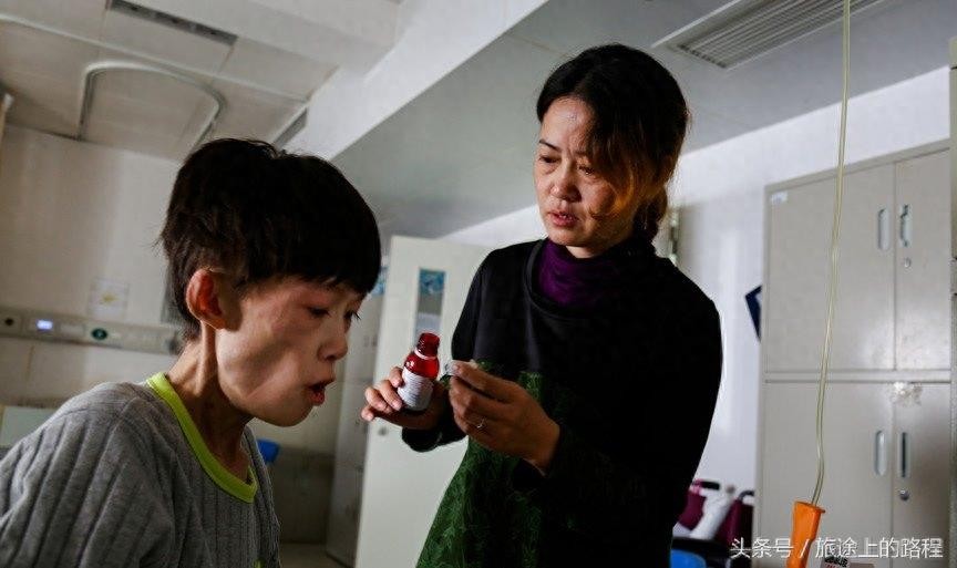 直击”骷髅男孩“一生，每天靠药物维持生活，亲戚建议“安乐死”