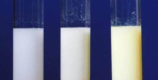 碘化银什么颜色(碘化银什么颜色是正常的)