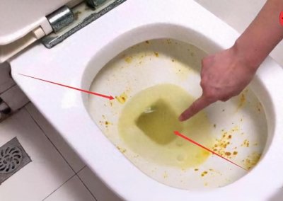 ​卫生间马桶里那些恼人的黄色污垢，保洁阿姨教你几招轻松去掉